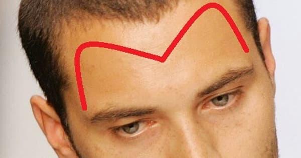 Tướng trán người đàn ông thông minh, thành đạt, giàu sang hơn người-2