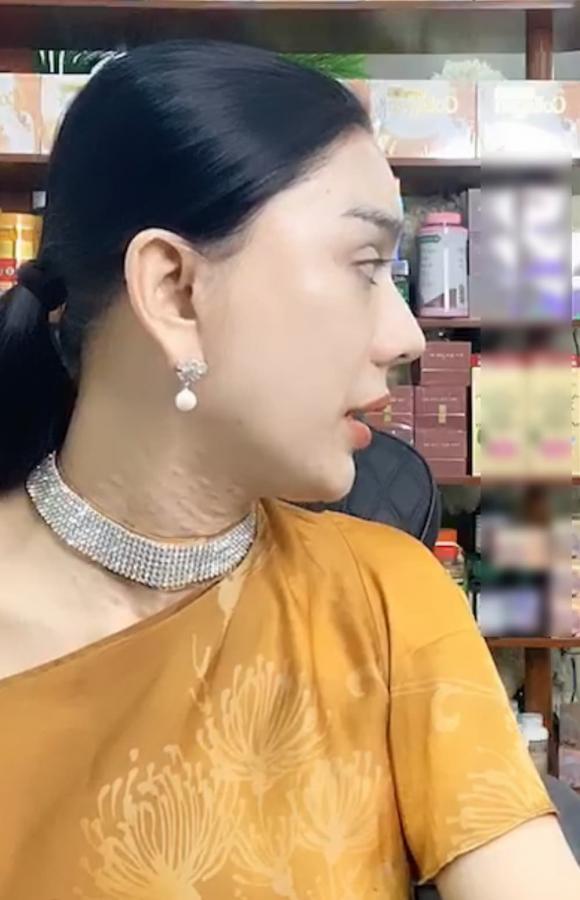 Lâm Khánh Chi xuống cấp, lộ da cổ nhăn nheo, sần sùi-5