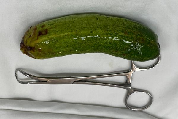 The young man stuffed a cucumber with a length of more than 10cm into his anus to… try a strange feeling