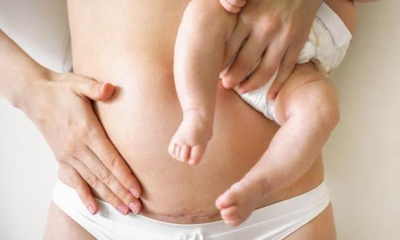 5 cách đơn giản giúp giảm mỡ bụng sau sinh-2
