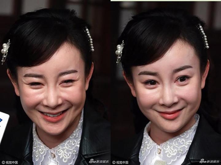 Thần tiên tỷ tỷ mất sự nghiệp vì giật chồng, biến dạng do dao kéo-5