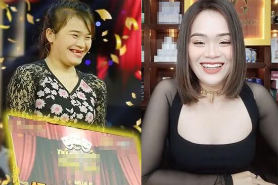 Không nhận ra 'thánh sún' Thách Thức Danh Hài sau 3 năm nổi đình đám