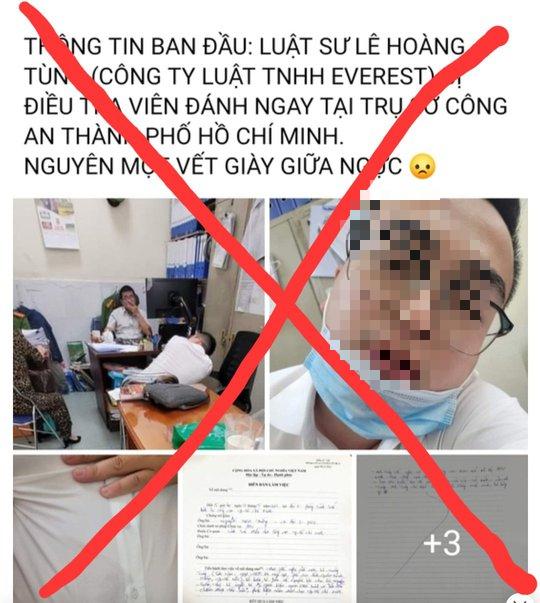 Luật sư tố bị điều tra viên hành hung, công an nói do… trượt ngã-1