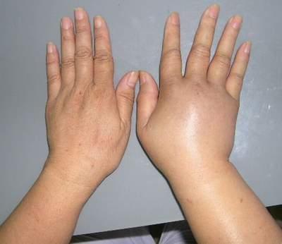 5 dấu hiệu bất thường khi uống nước cho thấy bạn có rất nhiều bệnh-2