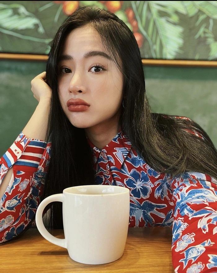 Angela Phương Trinh chuyển sang môi ong đốt sưng phù-1