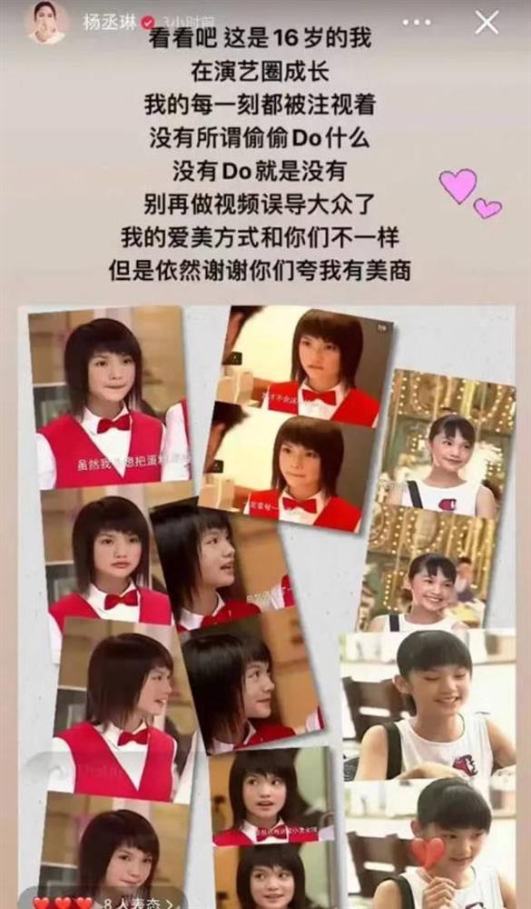 Dương Thừa Lâm đáp trả thông tin sửa nát mặt-2