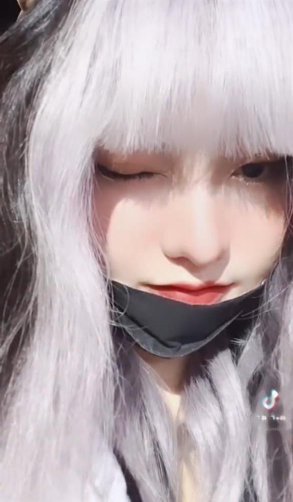 Bỏ 150 triệu để nâng mũi, hot TikToker CiiN lộ vết sưng phù-10