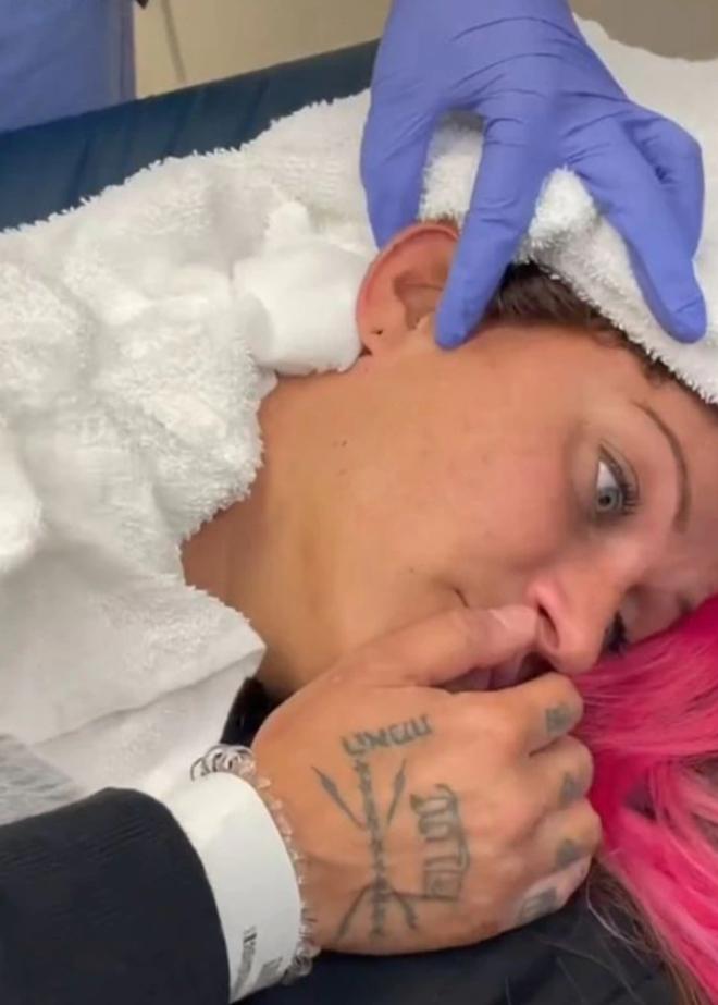 Đang ngủ bỗng thấy đau tai, cô gái kinh hãi khi thấy vật lạ lòi ra-1