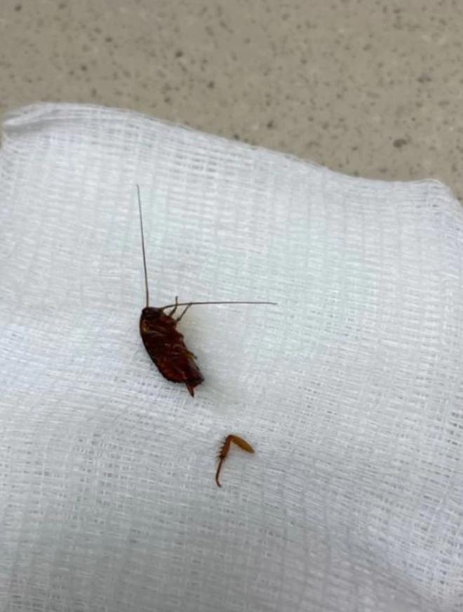 Đang ngủ bỗng thấy đau tai, cô gái kinh hãi khi thấy vật lạ lòi ra-3