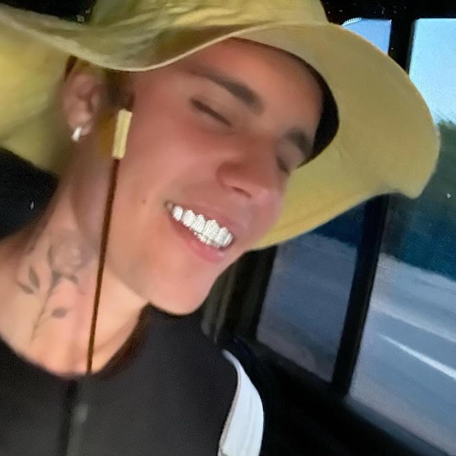 Johnny Dang làm bộ răng kim cương cho Justin Bieber-1
