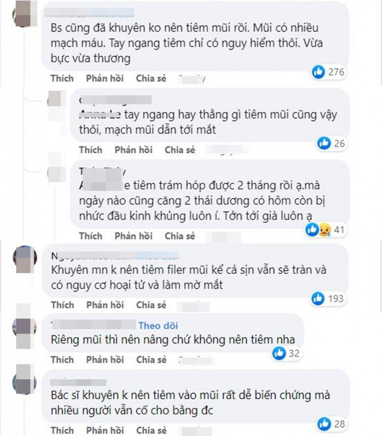 Cô gái tím đen hết mặt vì tiêm filler nâng mũi-2