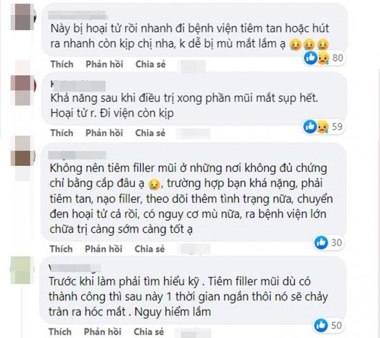 Cô gái tím đen hết mặt vì tiêm filler nâng mũi-3