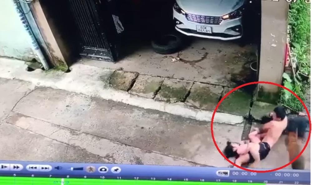 Bé gái bị 2 con chó tấn công, bố liều mạng giằng co để cứu con-4