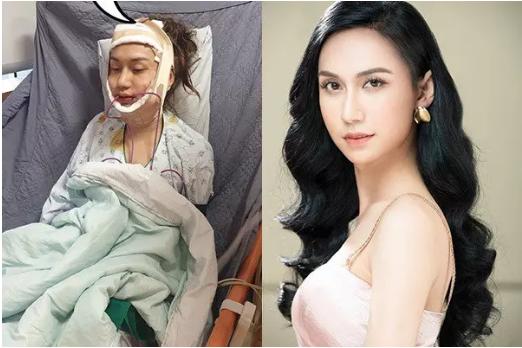 Lynk Lee hiếm hoi mặc áo tắm khoe 3 vòng điện nước đầy đủ-7