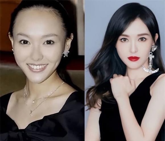 Làm sao để đường chân tóc không ảnh hưởng đến ngoại hình?-2