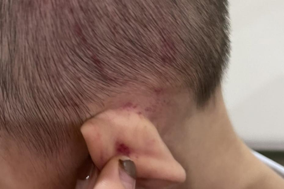 Phụ huynh trường quốc tế tố con gái bị đánh dã man, trường nói gì?-4