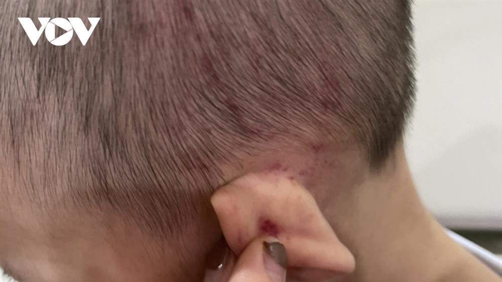 Cháu bé 2 tuổi ở Hải Phòng nghi bị bạo hành-1