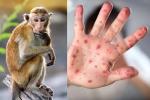 WHO: Biểu hiện lâm sàng của bệnh đậu mùa khỉ đã thay đổi-3
