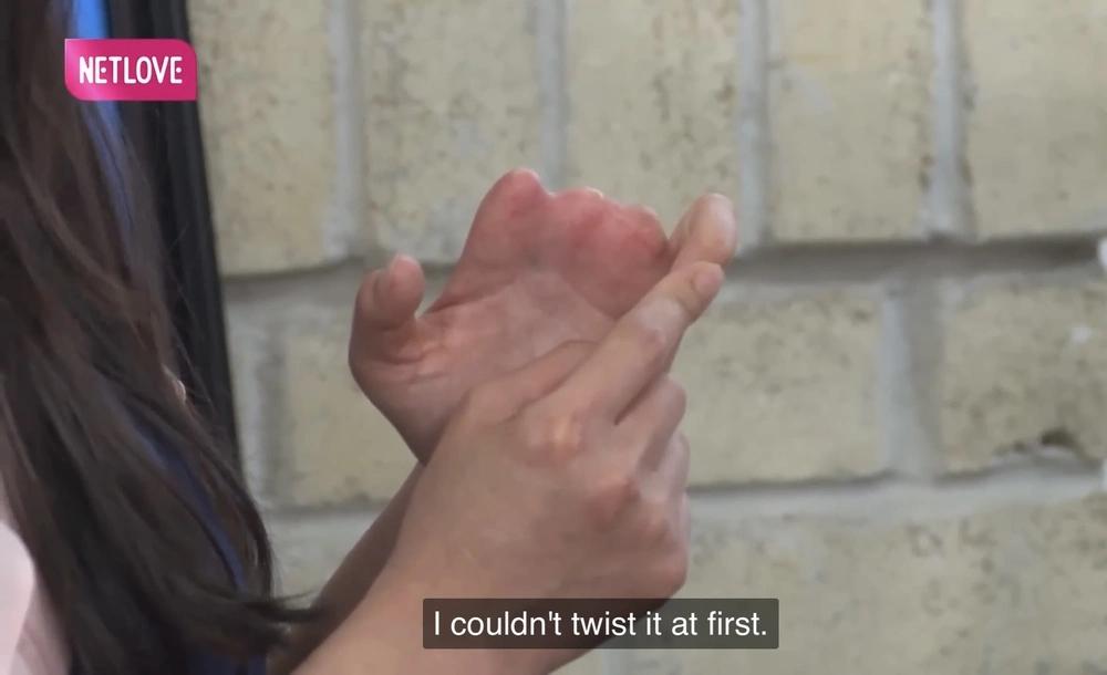 Chồng biền biệt ở Mỹ, vợ bán nước mía mưu sinh bị kẹp nát 3 ngón tay-3