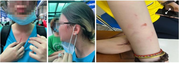 Phụ huynh trường quốc tế ở TP.HCM tố con bị bạn học đánh-1