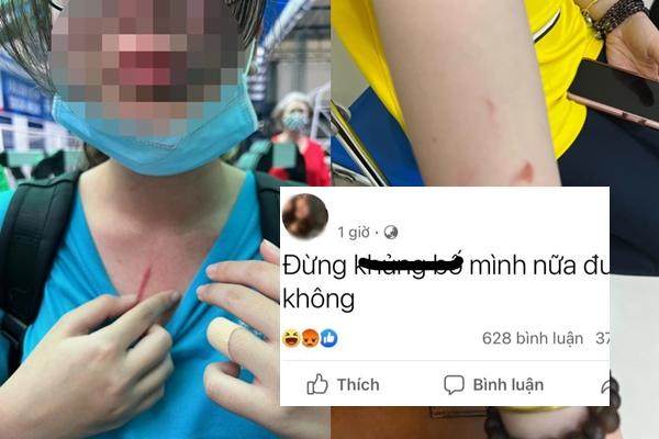 Clip: Cởi đồ, hành hung cảnh sát, cô gái bị quật ngã đau đớn-1