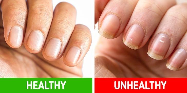 8 biểu hiện của cơ thể bạn không nên lơ là-2