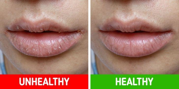 8 biểu hiện của cơ thể bạn không nên lơ là-3