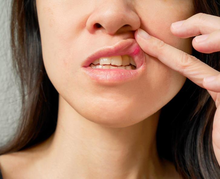 8 biểu hiện của cơ thể bạn không nên lơ là-5