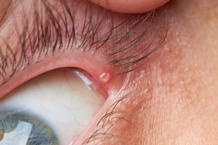 8 biểu hiện của cơ thể bạn không nên lơ là-6