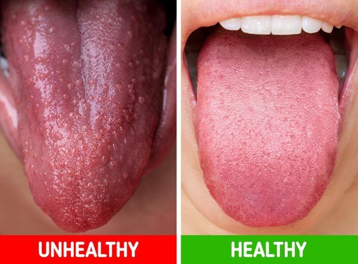 8 biểu hiện của cơ thể bạn không nên lơ là-7