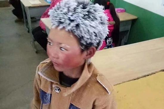'Cậu bé đóng băng' từng làm lay động bao người giờ ra sao?