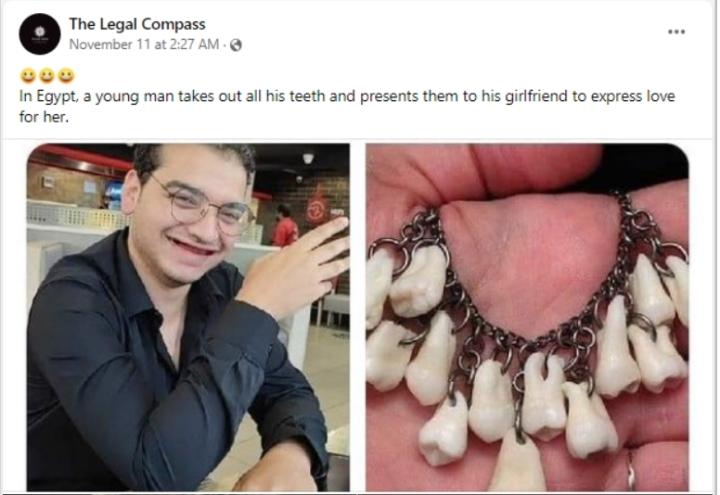 Sự thật ngã ngửa về anh chàng nhổ răng làm vòng tặng bạn gái-1