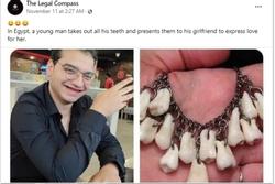 Sự thật ngã ngửa về anh chàng nhổ răng làm vòng tặng bạn gái