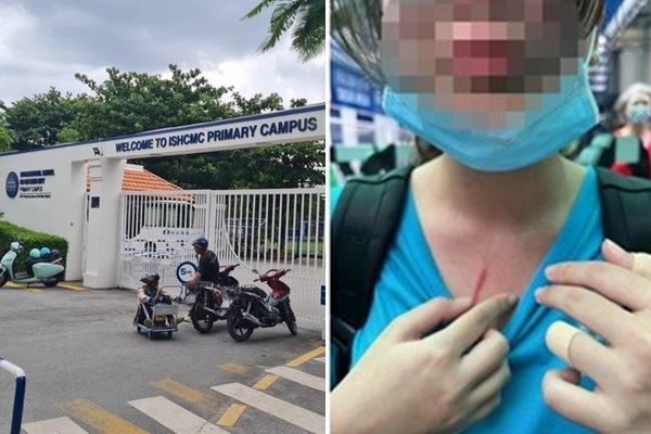 Trường quốc tế ở TP.HCM đã gửi bằng chứng vụ xô xát lên Sở GD&ĐT-2