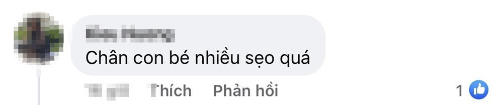 Thúy Hạnh bị chê để con chân đầy sẹo dự show thời trang-3