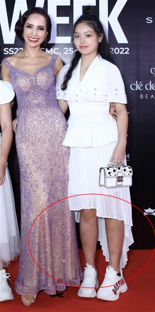 Thuy Hanh was criticized for her scarred legs to attend a fashion show-4