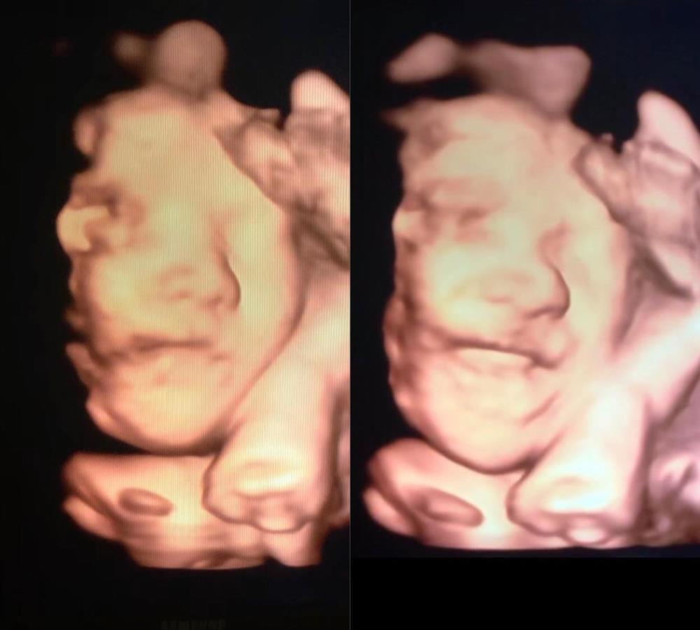 Hòa Minzy xả loạt ảnh mang thai, bất ngờ nhan sắc mẹ bầu-3