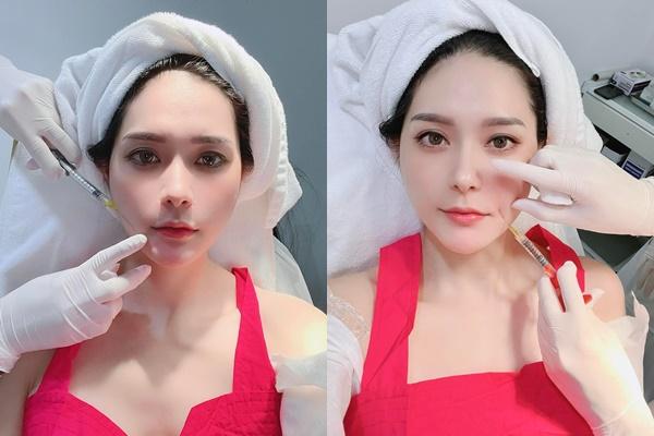Terrified of Doan Di Bang's acne-filled face-1