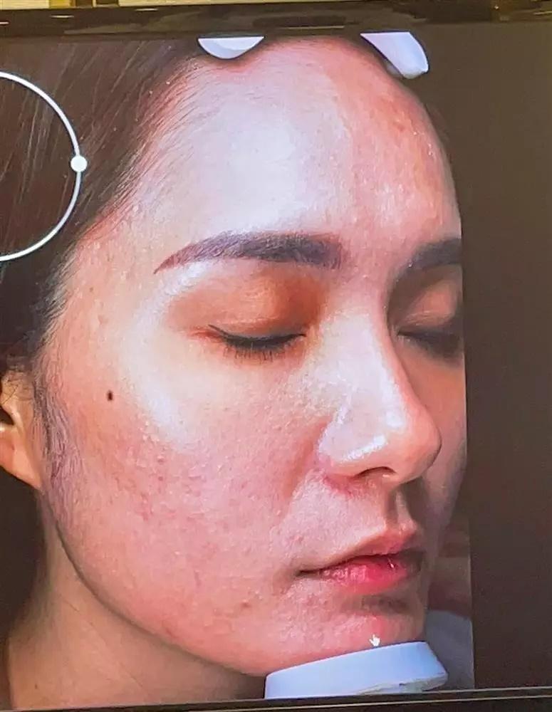 Terrified of Doan Di Bang's acne-filled face-3