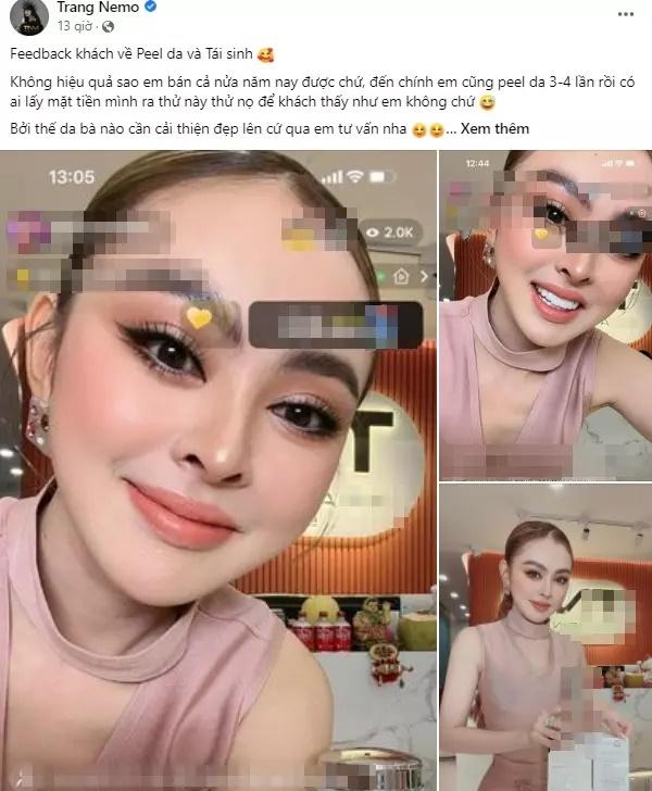 Cô gái như bỏng nặng khi dùng sản phẩm giống Trang Nemo-6