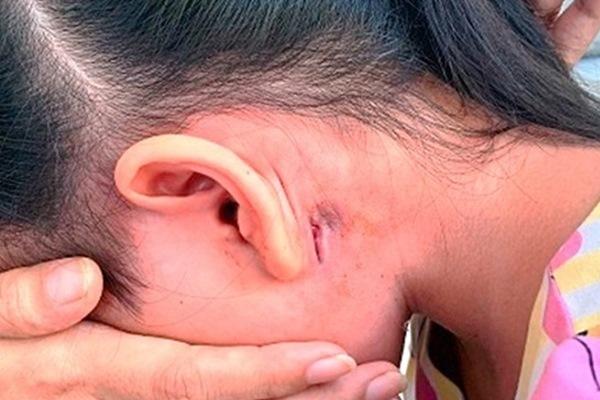 Người phụ nữ xinh đẹp bị cắt cụt tay chân do ăn cá rô phi nhưng mắc sai lầm-4