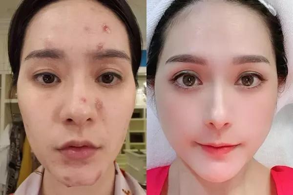 Đoàn Di Băng véo mũi khẳng định hàng real không dao kéo-2