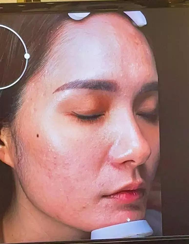 Đoàn Di Băng véo mũi khẳng định hàng real không dao kéo-3