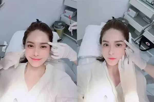 Đoàn Di Băng véo mũi khẳng định hàng real không dao kéo-5