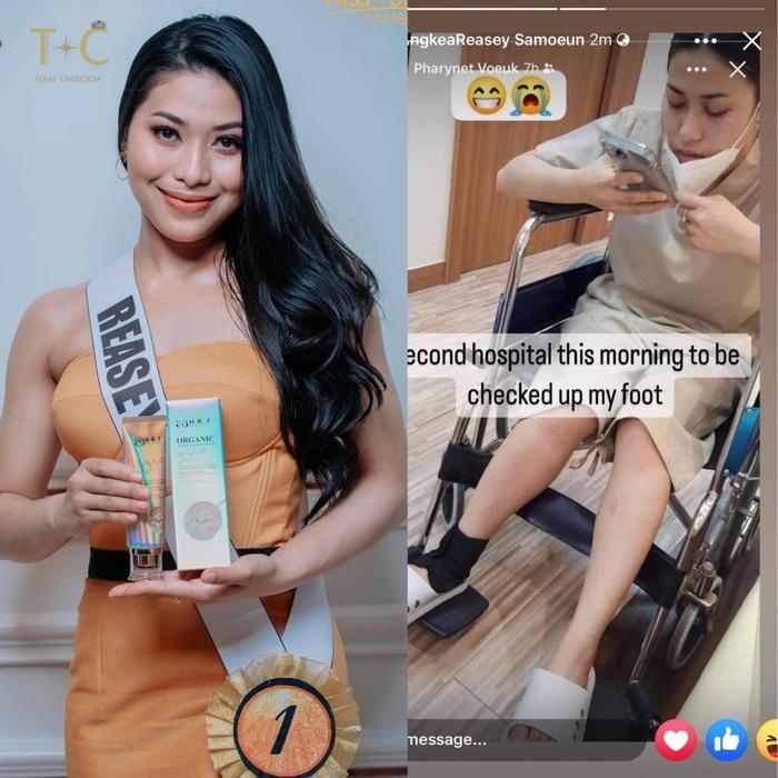 Người đẹp Campuchia đeo nạng gỗ trình diễn dạ hội-3