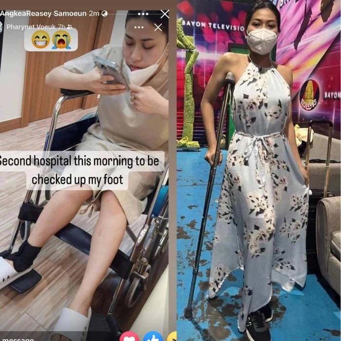 Người đẹp Campuchia đeo nạng gỗ trình diễn dạ hội-4