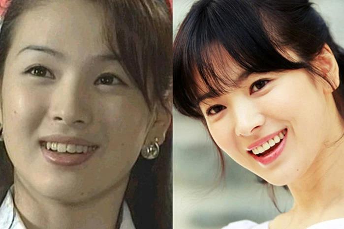 Điểm danh những mỹ nhân Hàn lột xác chẳng cần dao kéo-3