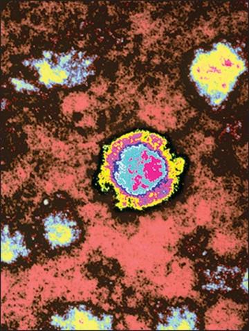 Virus hiếm gây tử vong gần 100% tái xuất-1