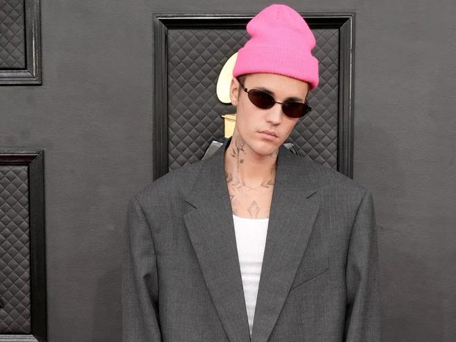 Justin Bieber cầu cứu vì liệt cơ mặt-3