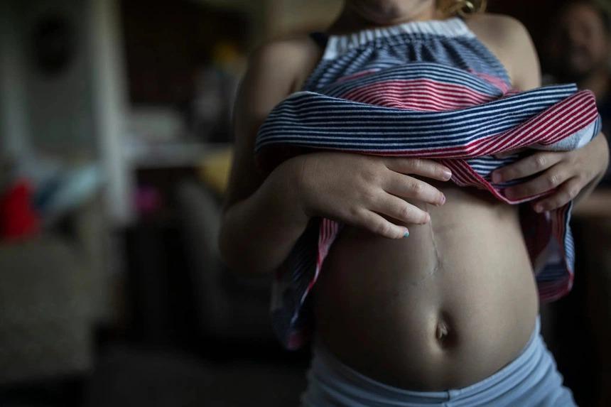 Cuộc sống của em bé 4 tuổi sau khi thoát chết vì viêm gan bí ẩn-2